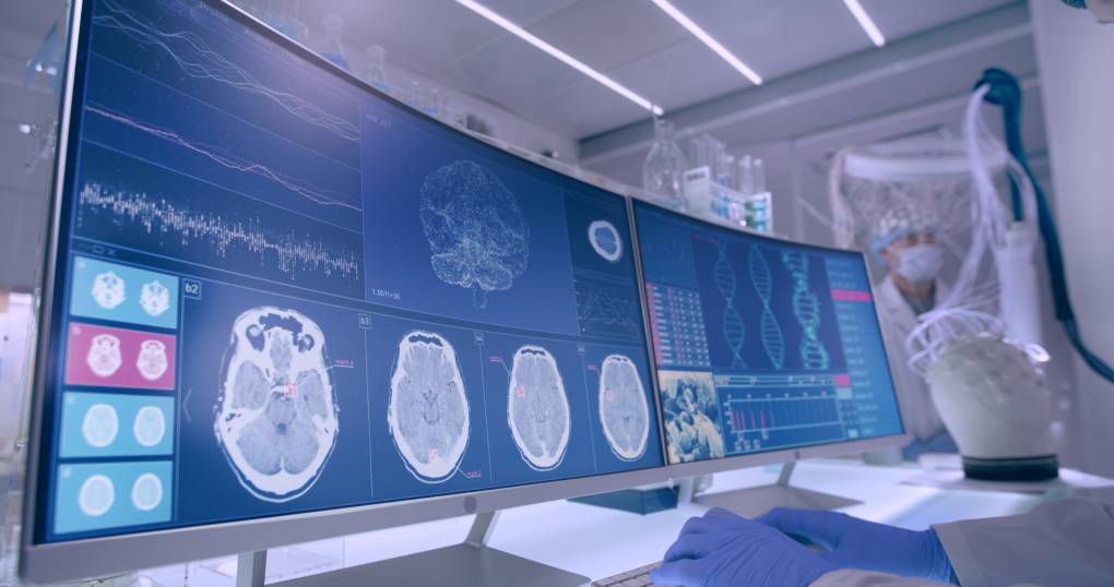 Images of brains and brain waves on a large computer screen in a laboratory setting.